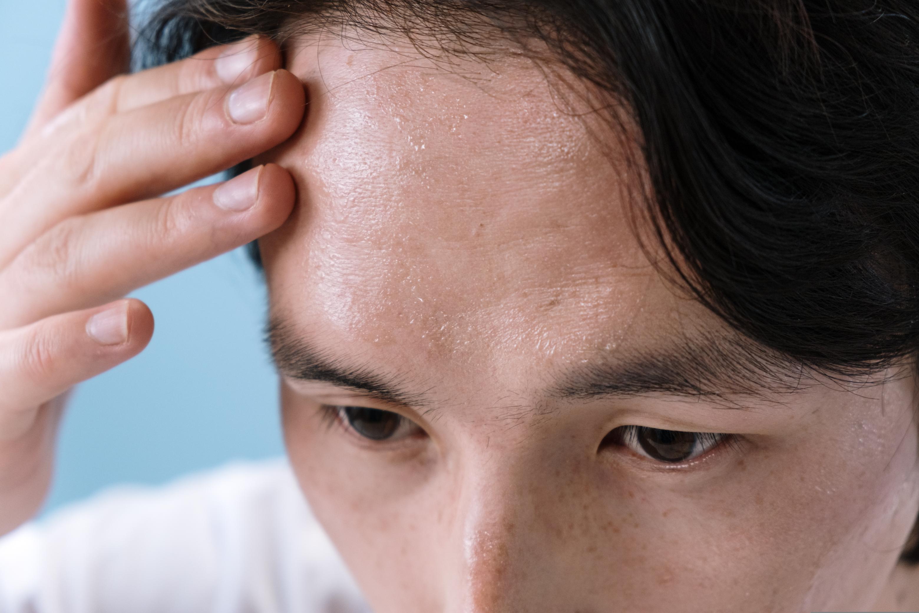 The symptoms of lice infestation